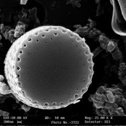 Diatomee (Aulacoseira alpigena) osservate al microscopio (E. Falasco) 