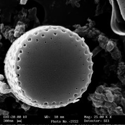 Diatomee (Aulacoseira alpigena) osservate al microscopio (E. Falasco) 