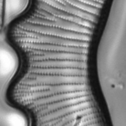 La diatomea, Eunotia tetraodon, (E. Falasco)